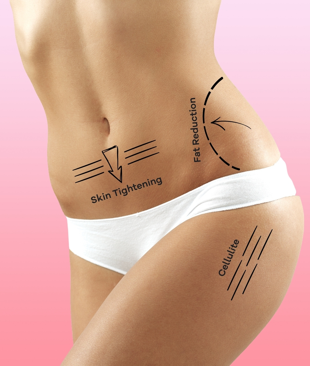 Bespoke Skin Tightening
