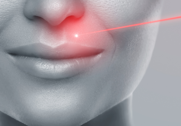 laser hair removal